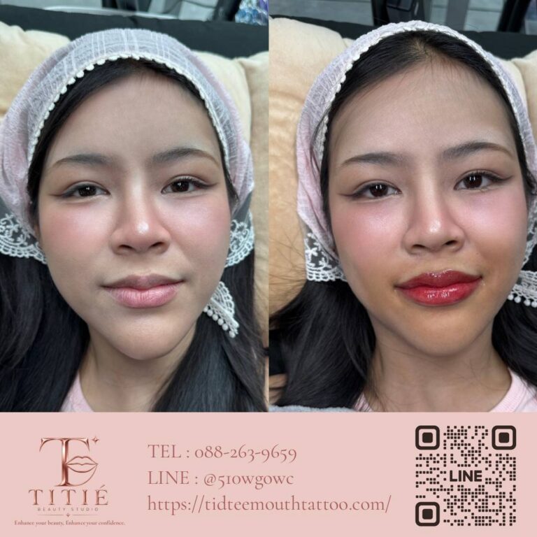 ก่อนและหลังสักปาก ฝังสีปาก เคสจริงที่ 1 ปากดูสีสม่ำเสมอเป็นธรรมชาติขึ้น — TITIÉ Beauty Studio