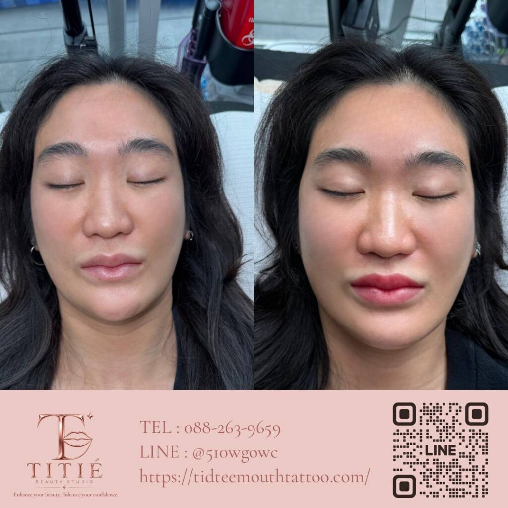 ก่อนและหลังสักปาก ฝังสีปาก เคสจริงที่ 2 แก้ปากคล้ำให้ดูสดใสขึ้น — TITIÉ Beauty Studio