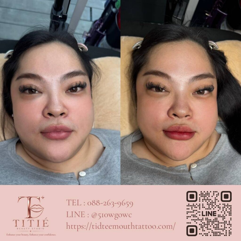ก่อนและหลังสักปาก ฝังสีปาก เคสจริงที่ 3 ปากชมพูดูเป็นธรรมชาติ — TITIÉ Beauty Studio