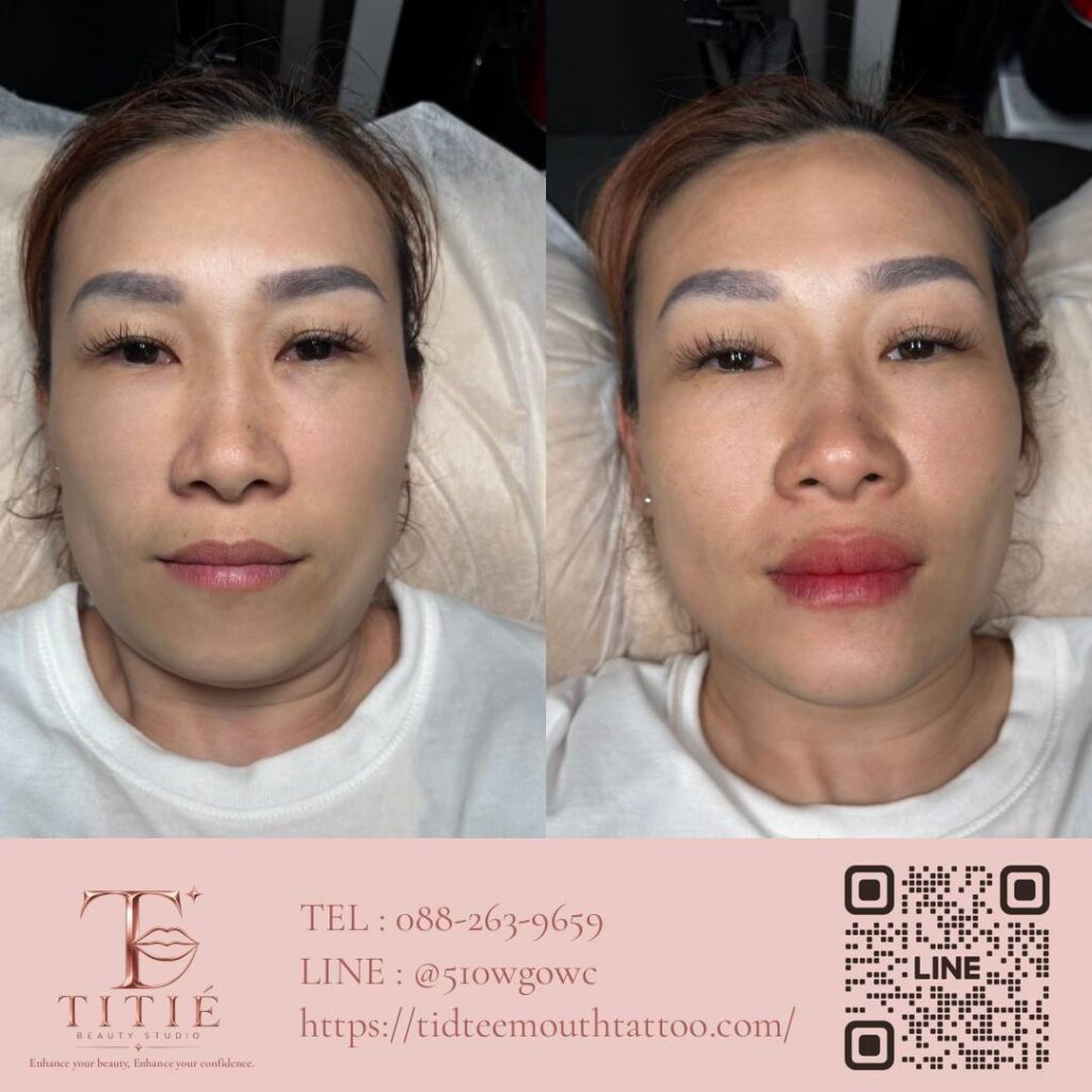 ก่อนและหลังสักปาก ฝังสีปาก เคสจริงที่ 4 ปากดูอิ่มและมีสีสันขึ้น — TITIÉ Beauty Studio
