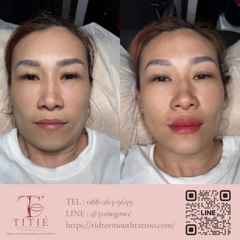 ก่อนและหลังสักปาก ฝังสีปาก เคสจริงที่ 4 ปากดูอิ่มและมีสีสันขึ้น — TITIÉ Beauty Studio