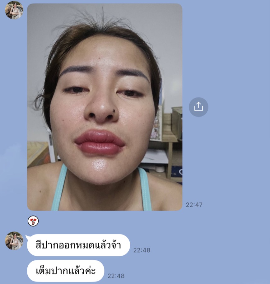 รีวิวสักปากจากคุณมะลิ รูปปากหลังสีเข้าที่ สีออกเต็มปากสม่ำเสมอ