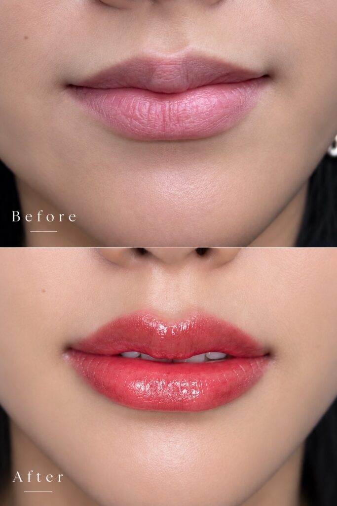 ก่อนและหลังฝังสีปาก Lip Tattoo ทันทีหลังทำเสร็จ จากปากชมพูอ่อนเป็นแดงอมส้มฉ่ำ โดย TITIÉ Beauty Studio
