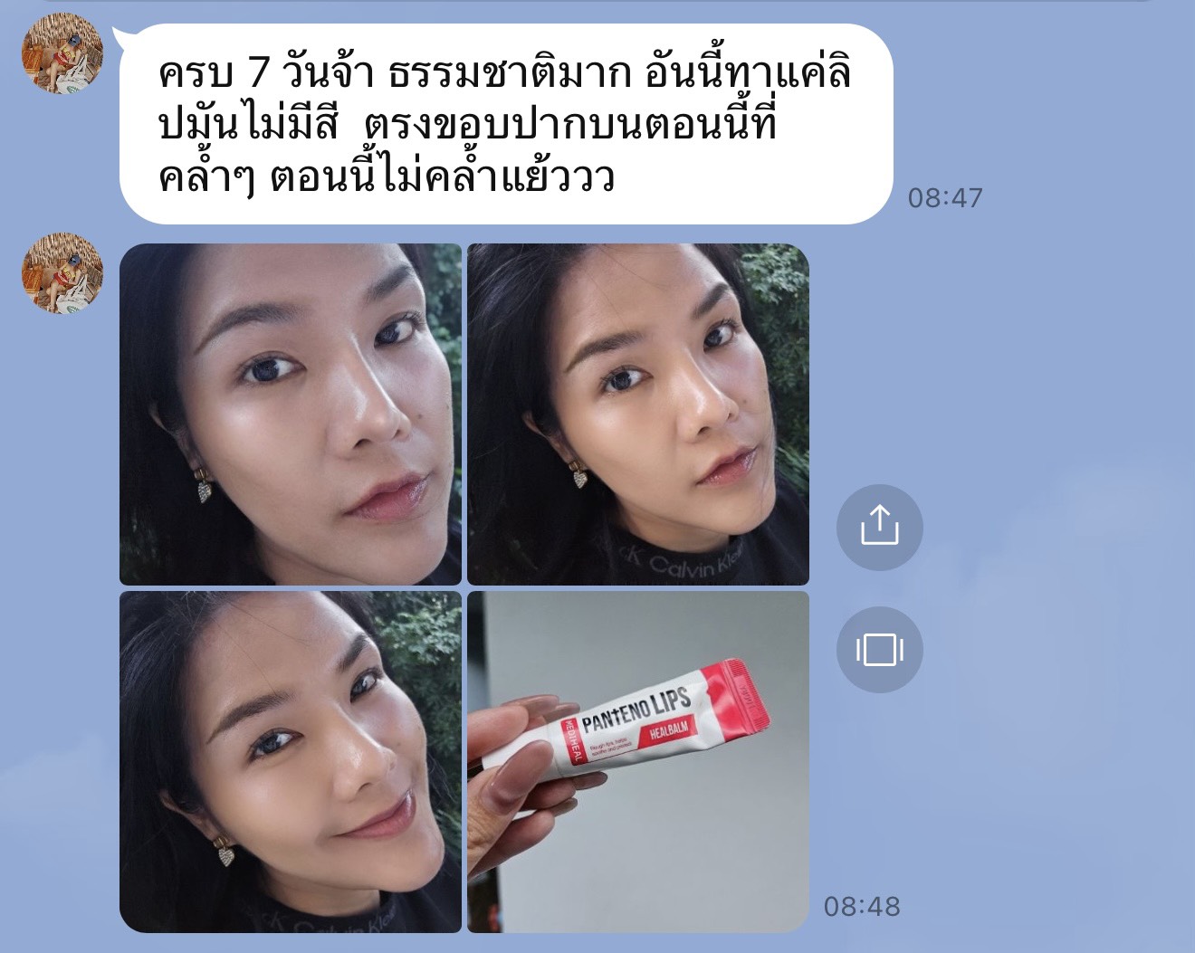 ข้อความรีวิวจากคุณแนนทางไลน์ ครบ 7 วันหลังสักปาก ธรรมชาติมาก ขอบปากที่เคยคล้ำไม่คล้ำแล้ว พร้อมรูปปากหลังลอก